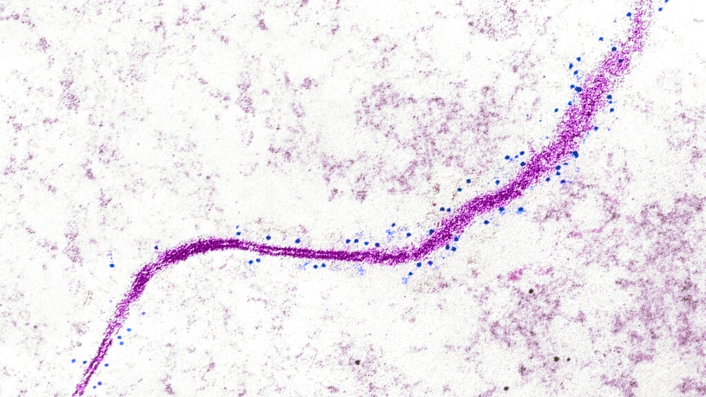 A Serendipitous Discovery: How a Misplaced Protein Could Revolutionize Immunotherapy for Solid Tumors