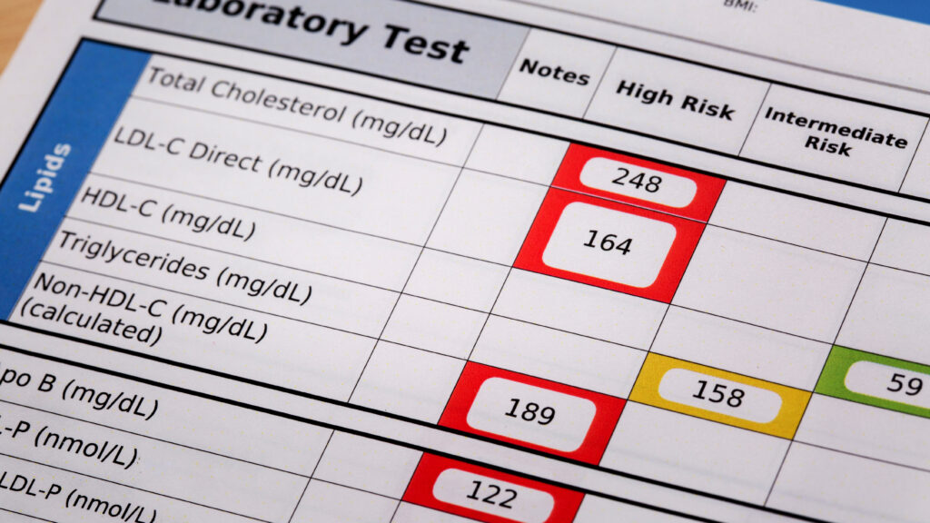 Major changes to cardiovascular guidelines suggest taking statins as young as 30 