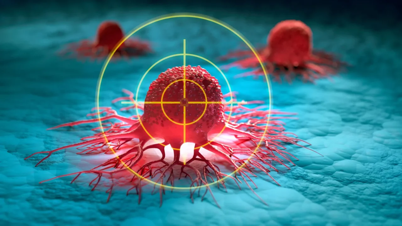Scientists find a new weakness in treatment-resistant prostate cancer